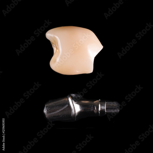 custom implant abutment