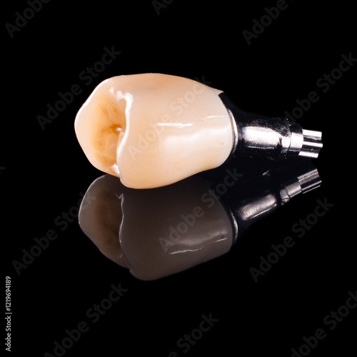 custom implant abutment