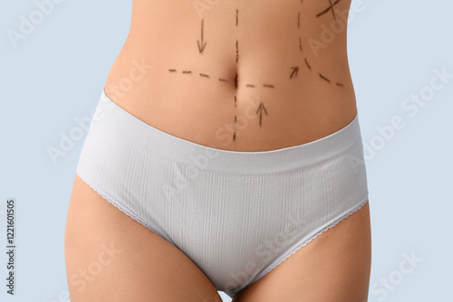 Young woman in underwear with marks on her abdomen against light background, closeup. Plastic surgery concept