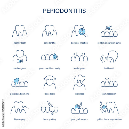 Periodontitis symptoms, diagnostic and treatment vector icon set. Medical icons.