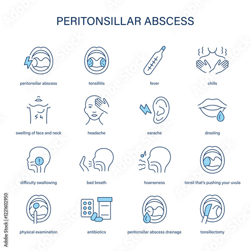 Peritonsillar Abscess symptoms, diagnostic and treatment vector icon set. Medical icons.