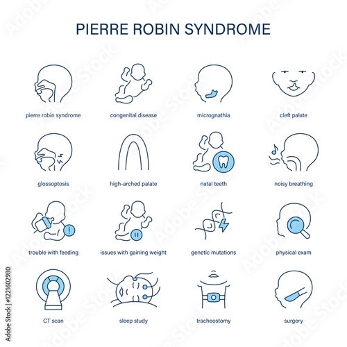 Pierre Robin Syndrome symptoms, diagnostic and treatment vector icon set. Medical icons.