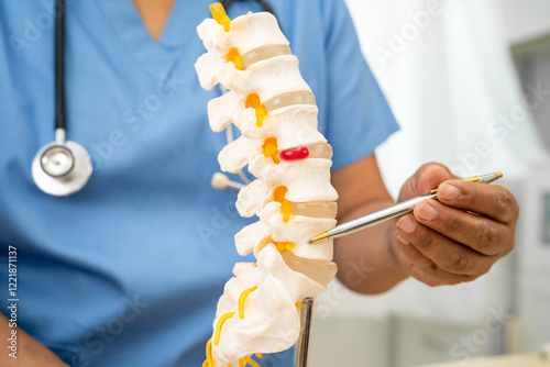 Doctor with lumbar vertebra bone skeleton and nerve model for treatment in the orthopedic department.