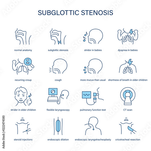 Subglottic Stenosis symptoms, diagnostic and treatment vector icon set. Medical icons.
