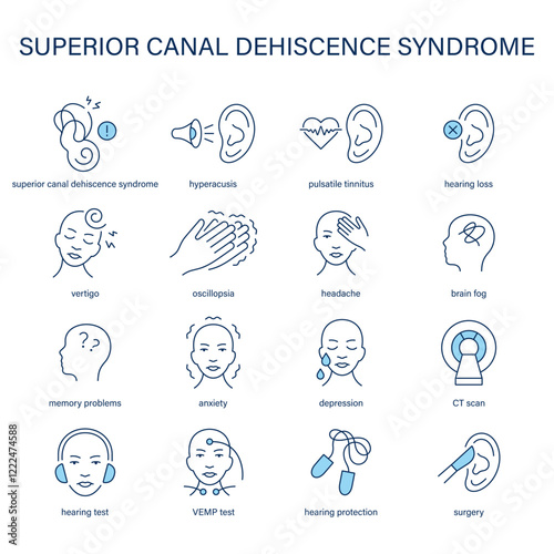Superior Canal Dehiscence Syndrome symptoms, diagnostic and treatment vector icon set. Medical icons.
