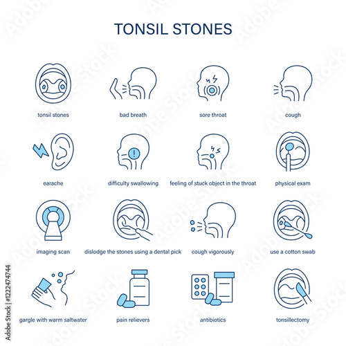 Tonsil Stones symptoms, diagnostic and treatment vector icon set. Medical icons.