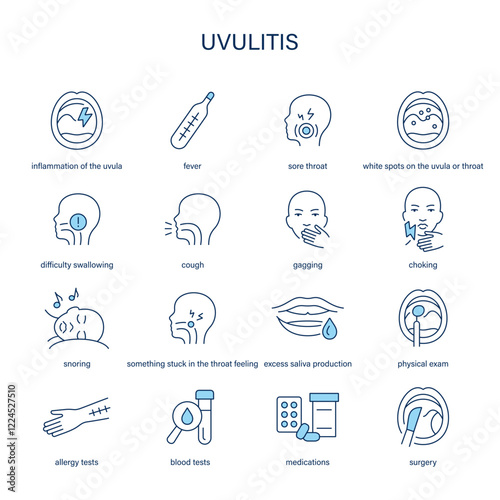 Uvulitis symptoms, diagnostic and treatment vector icon set. Medical icons.