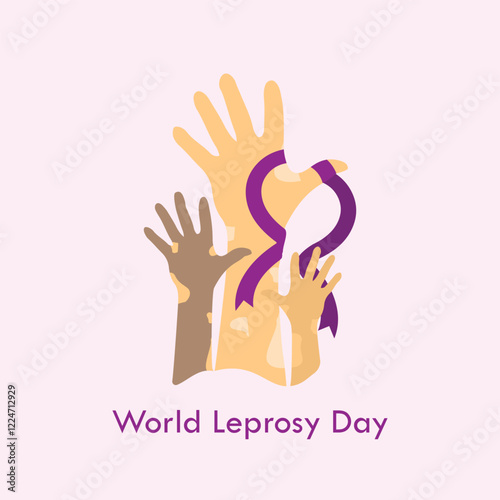 World Leprosy Day vector illustration. 30 January. Leprosy, also known as Hansen's disease, is a chronic bacterial infection that affects the skin, nerves, eyes, and nose.