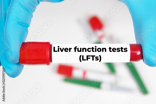 Liver function tests (LFTs) medical analysis value test tube background photo