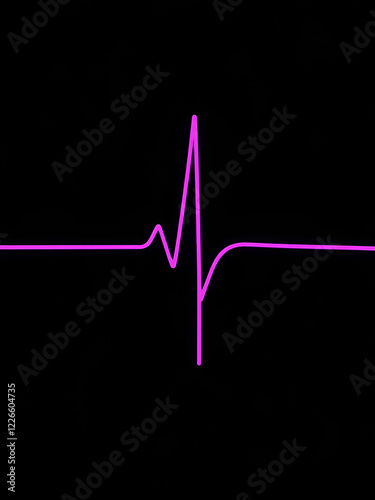 Artrial fibrilation (AF) is one of the causes of cerebral embolization and ischemic stroke. photo