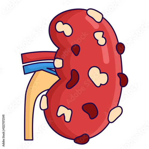 Kidney disease