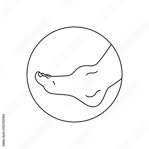edema