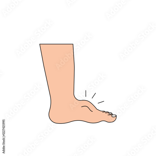 edema illustration