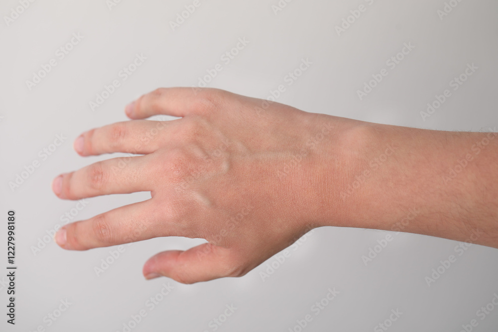Woman with visible hand veins on light grey background, closeup Woman with visible hand veins on light grey background, closeup