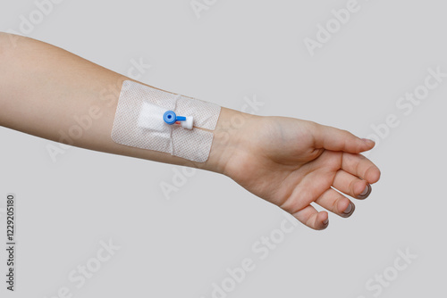 Medicine concept. Peripheral Catheter for Multiday Therapy