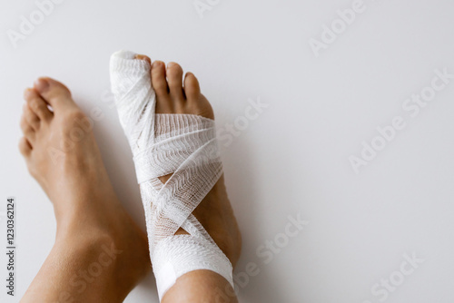 Fracture of the big toe. Bandaged foot with white bandage on a light background. Medical concept. Copy Space