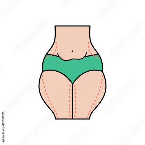 Slim liposuction flat design. Cosmetic surgery on women body with dotted lines. For plastic surgery clinic, medical and beauty publications