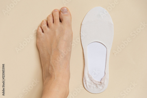 foot with ingrown nail and insole in the background. Concept of ingrown nail, onychocryptosis. Non-surgical correction of ingrown nail, Podofix correction systems