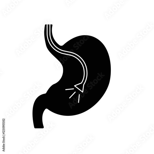 Endoscopy