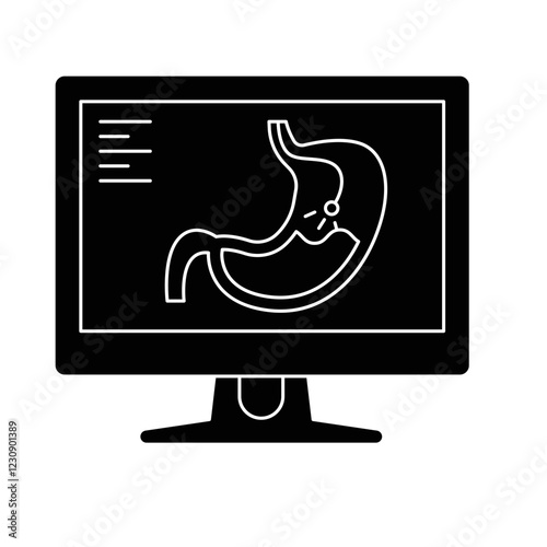 Endoscopy