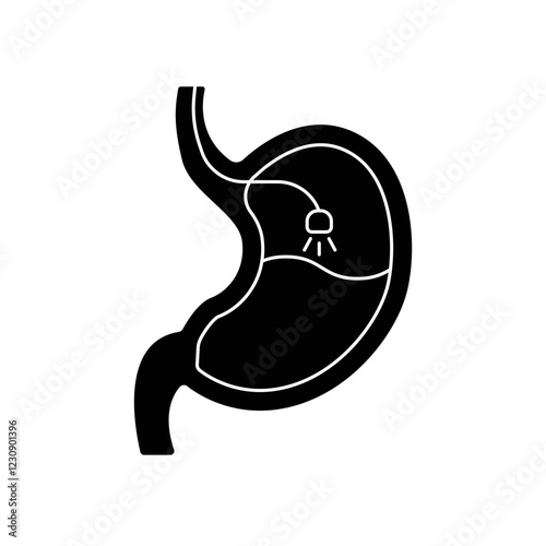Endoscopy