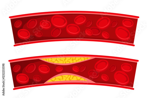 Vector image of artery. Arteries with cholesterol. Medical illustration for studying human and his body. Element for your design.