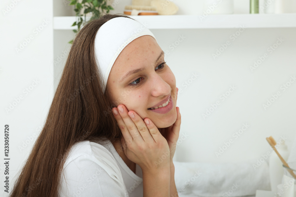 Teenage girl with acne problem at home. Space for text Teenage girl with acne problem at home. Space for text