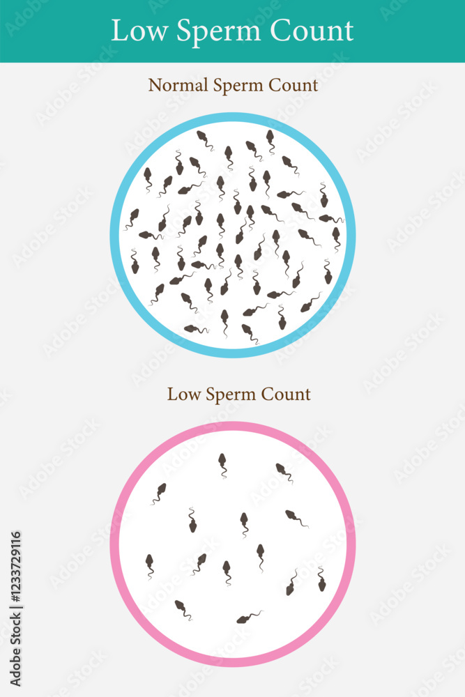 comparison of normal sperm and low sperm count. medical illustration comparison of normal sperm and low sperm count. medical illustration