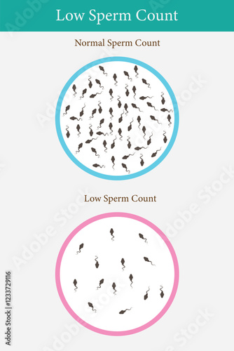 comparison of normal sperm and low sperm count. medical illustration