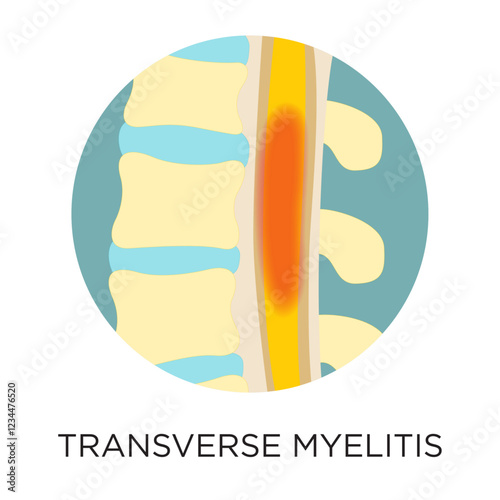 Vector Transverse Myelitis Icon
