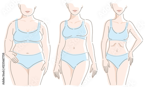 Three types of body of women. Obese, average, skinny. Vector illustration isolated on white background.