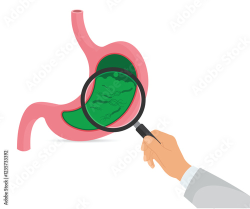 Helicobacter Pylori in the stomach stock illustration