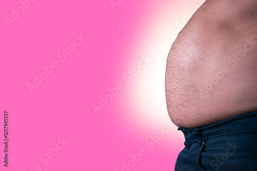 obese man belly fat side view, Cushing's syndrome concept, diabetes concept, man's fat abdomen 