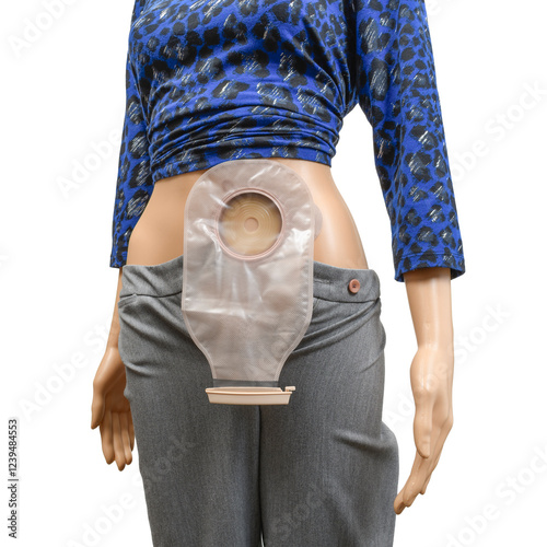 Two-Part Colostomy Shown on Mannequin photo