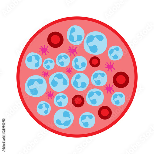neutrophilia