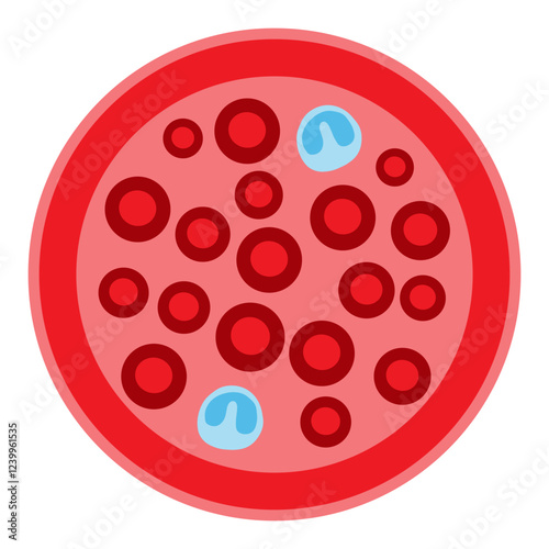 eosinopenia