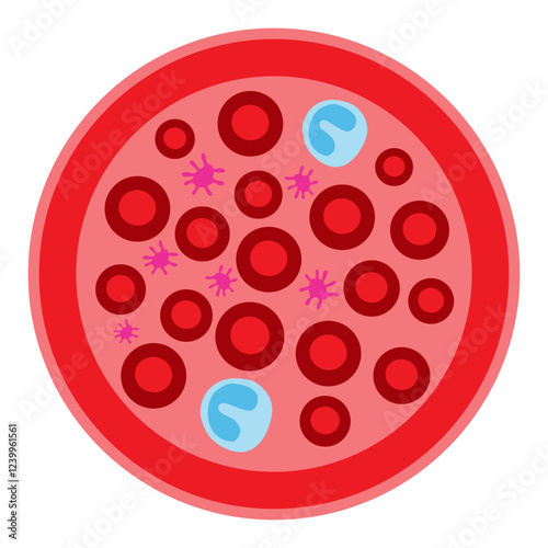 eosinopenia