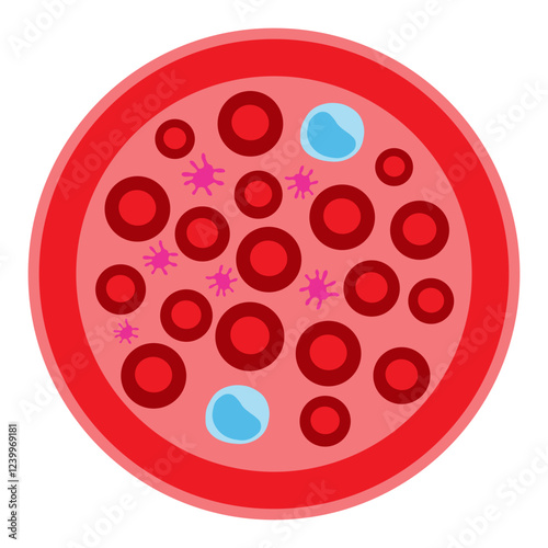 lymphocytopenia