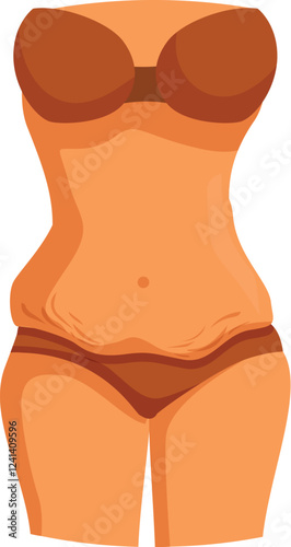 Female body with stretch marks on belly, waist and hips, wearing brown underwear, concept of body positivity, postpartum, weight loss and skin care