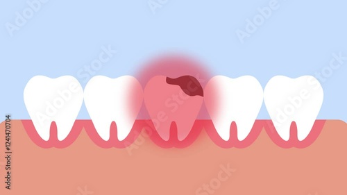 Dead tooth hurting and giving a red pain signal 4K animation cartoon for education kids