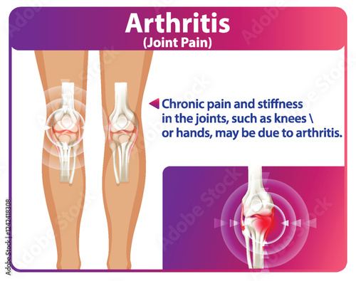 Understanding Arthritis and Joint Pain