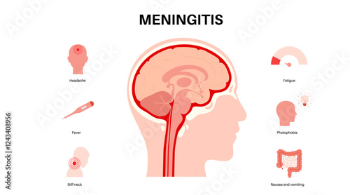 Meningitis medical poster