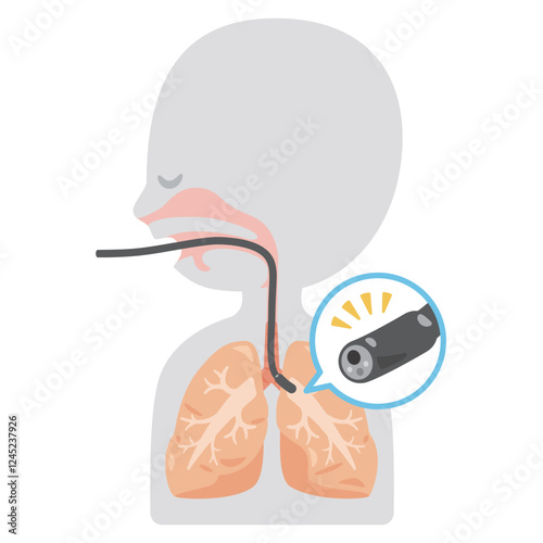 気管支鏡検査を受けるシンプルな人物の横顔イラスト