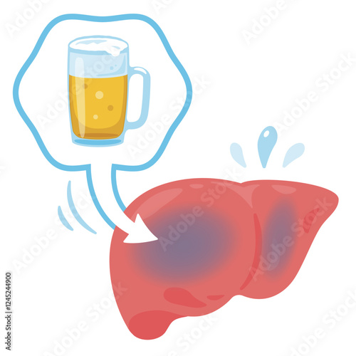 アルコールのダメージを受ける肝臓のイラスト