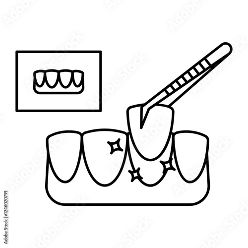 cosmetic teeth Veneers  treatment concept, Tooth crown or cap bridge Hybrid Designed Dental Bridge vector icon design, Dentistry symbol, Healthcare sign, Dental instrument illustration