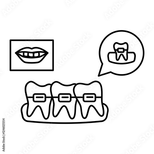 Teeth Aligners or metal wired braces with Before After smile concept, Lingual orthodontic treatment appliances vector icon design, Dentistry symbol, Healthcare sign, Dental instrument illustration