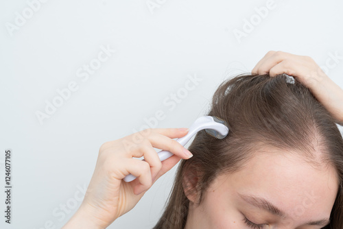 Close up of brunette woman using microneedling derma roller on scalp for stimulating new hair growth, copy space. Alopecia treatment, scalp stimulation, hair loss and baldness targeted therapy.