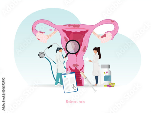 edical representation of endometriosis with doctors evaluating the uterus, highlighting diagnosis, treatment, and symptoms of the gynecological disease.