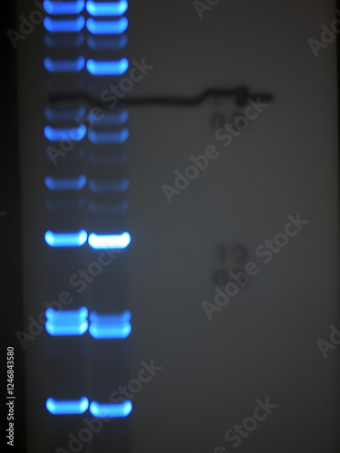 Western blot analysis is a protein detection technique used in medical or research labs for detecting HIV infection and studying cancer biology photo