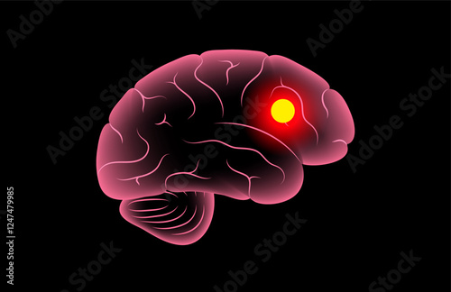 Brain cancer poster